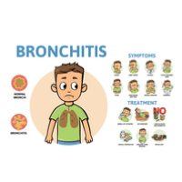 Stages from Bronchitis. Stages from Bronchitis.